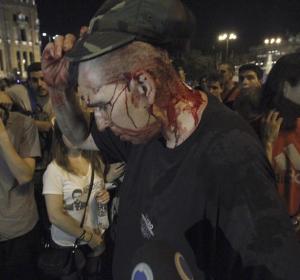 Herido en Madrid durante la manifestación