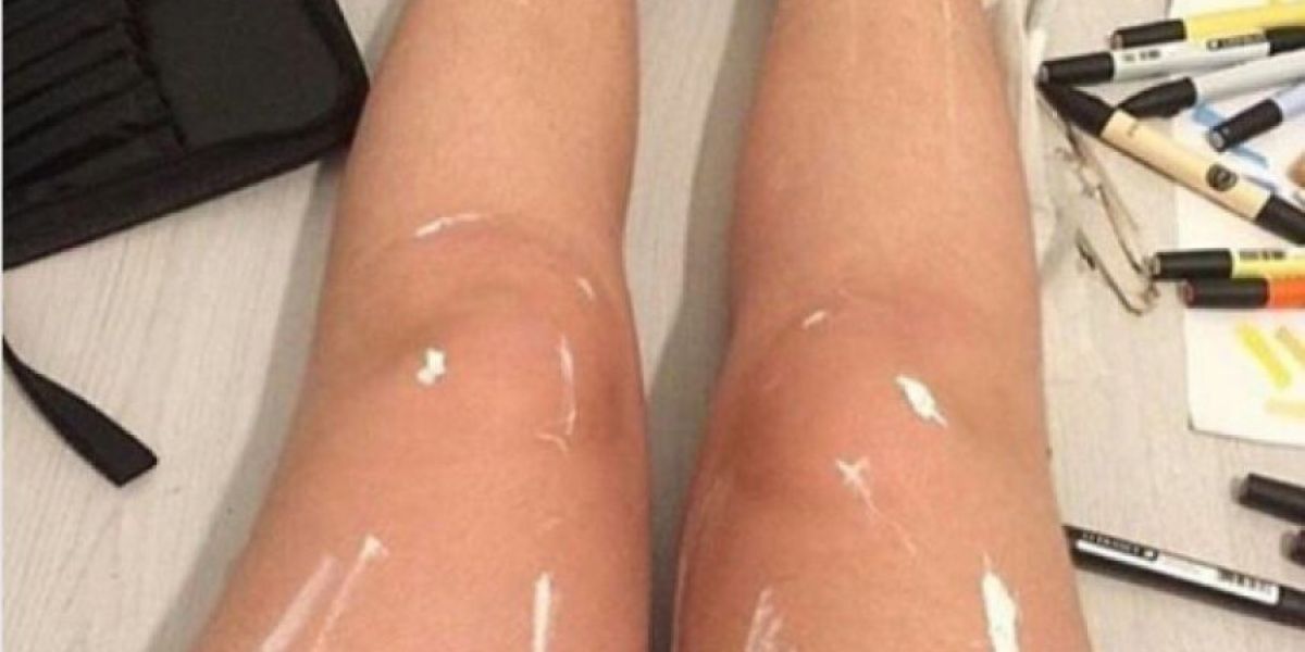 ¿Qué hay de extraño en este par de piernas?