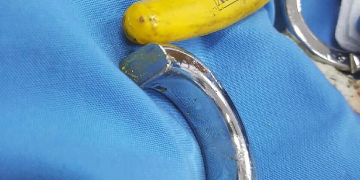 El anillo no estaba homologado