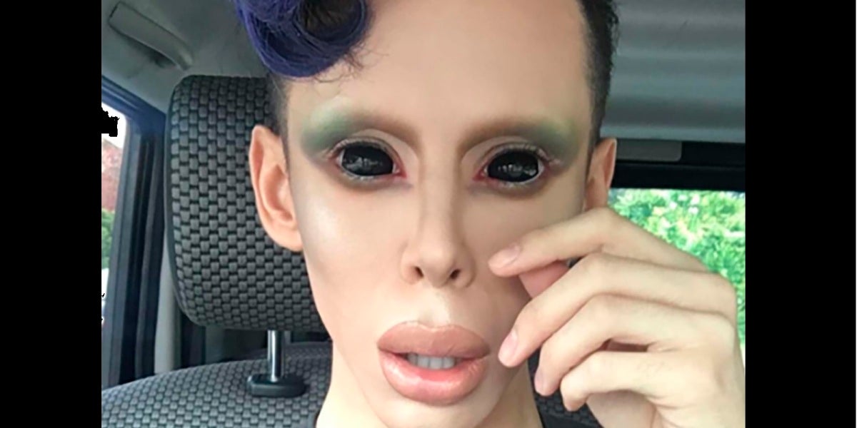 Vinny Ohh, el joven que se ha transformado en 'alien'