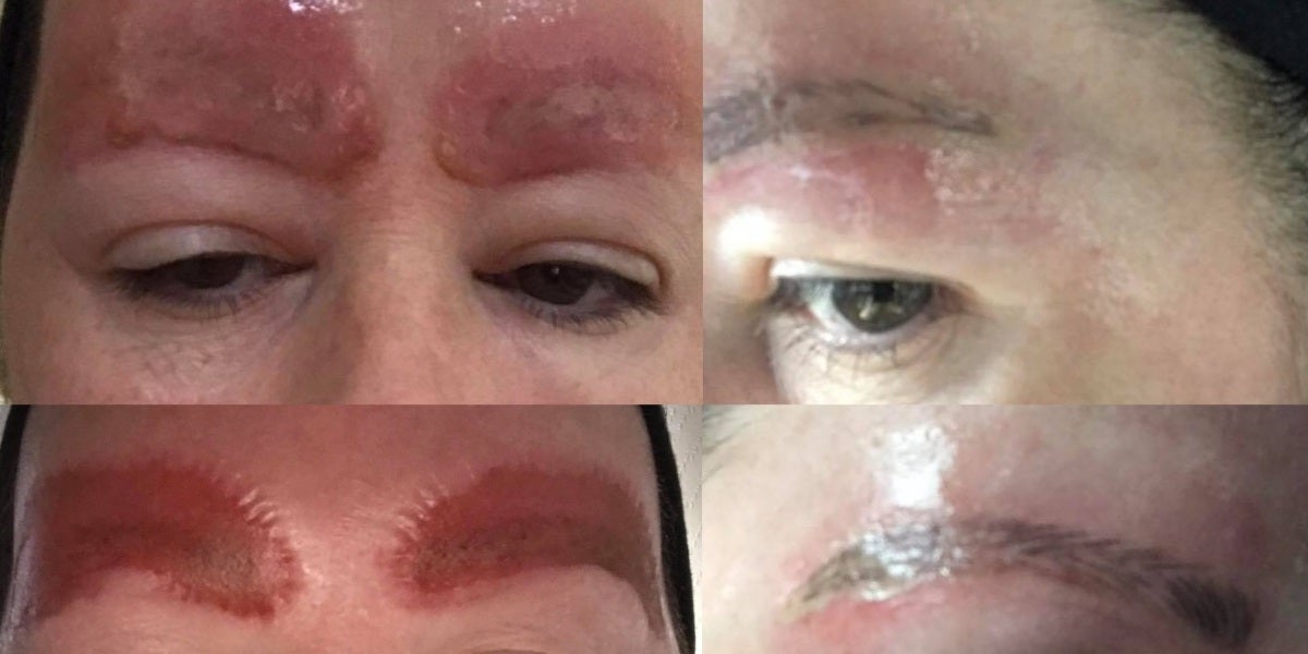 Así quedaron las cejas de la mujer tras hacerse el tatuaje