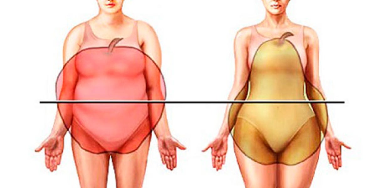 Los dos grandes tipos de obesidad