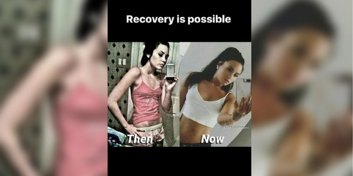 Demi Lovato comparte una foto de su lucha contra la bulimia