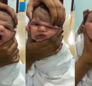Uno de los bebés maltratados por las enfermeras para divertirse Uno de los bebés maltratados por las enfermeras para divertirse