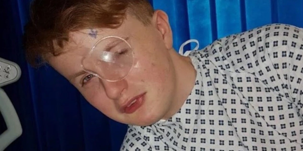 Un niño de 15 años se queda ciego de un ojo después de que un compañero le clavase una pluma