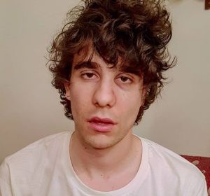 Javier Calvo muestra su cara tras la agresión en Lisboa Javier Calvo muestra su cara tras la agresión en Lisboa