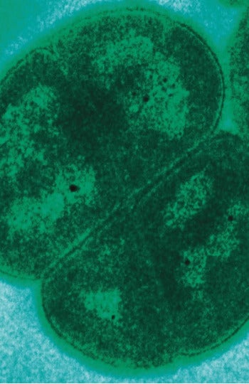 Imagen del Deinococcus radiodurans tomada con un microscopio de transmisión de electrones