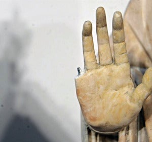 Detalle de la mano dañada