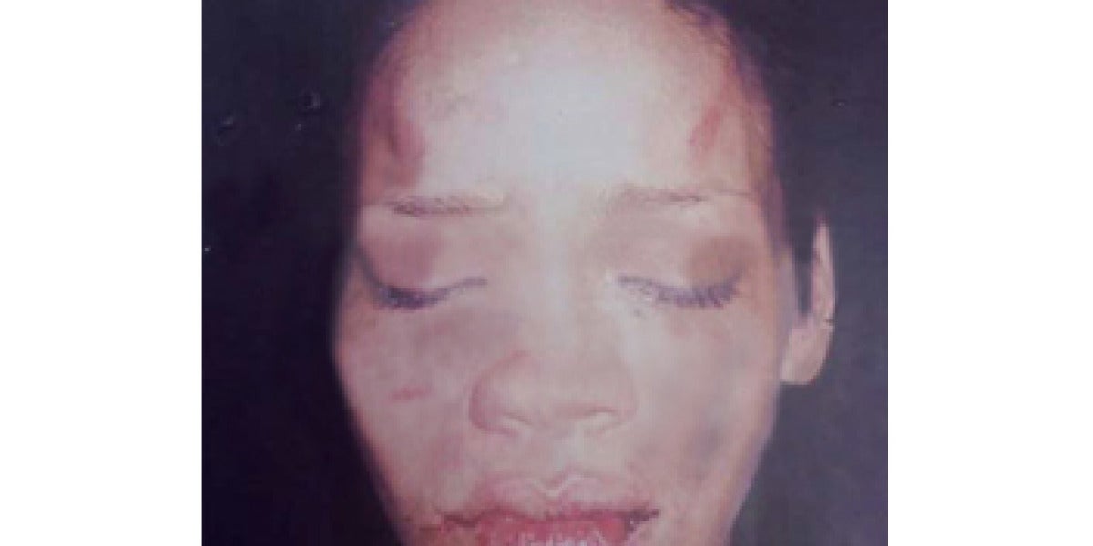 Rihanna tras ser maltratada por Chris Brown