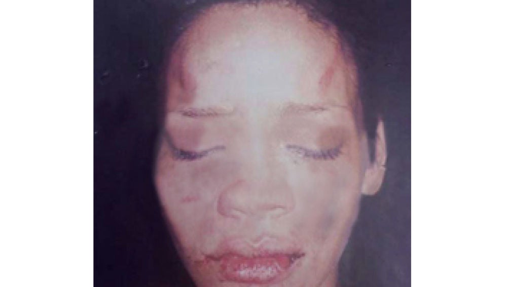 Rihanna tras ser maltratada por Chris Brown