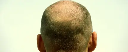 “Todo cambió cuando me hicieron una foto por detrás" “Todo cambió cuando me hicieron una foto por detrás"