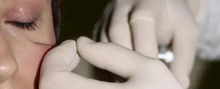 Cirugía estética Cirugía estética