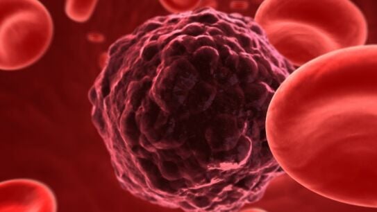 Mutaci&oacute;n de una c&eacute;lula cancer&iacute;gena