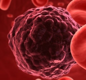 Mutación de una célula cancerígena Mutación de una célula cancerígena