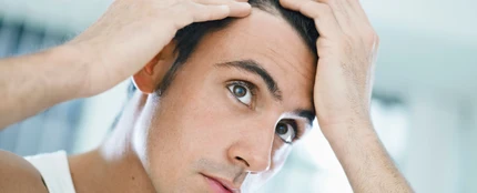 Implantes de pelo antiguos Implantes de pelo antiguos