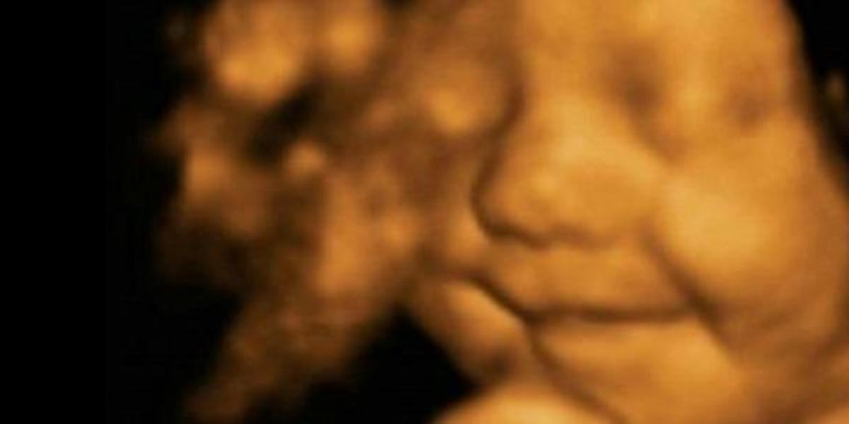 Una ecografía en 4D de un bebé sonriendo