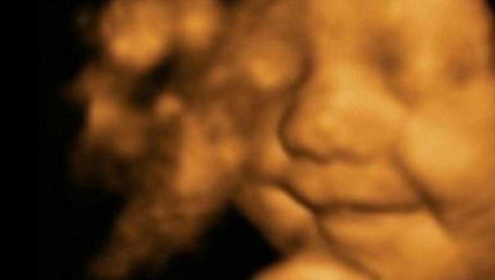 Una ecografía en 4D de un bebé sonriendo
