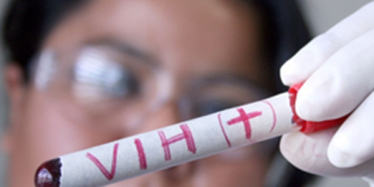 Muestra de VIH en un laboratorio