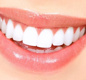 Imagen de la sonrisa de una mujer Imagen de la sonrisa de una mujer