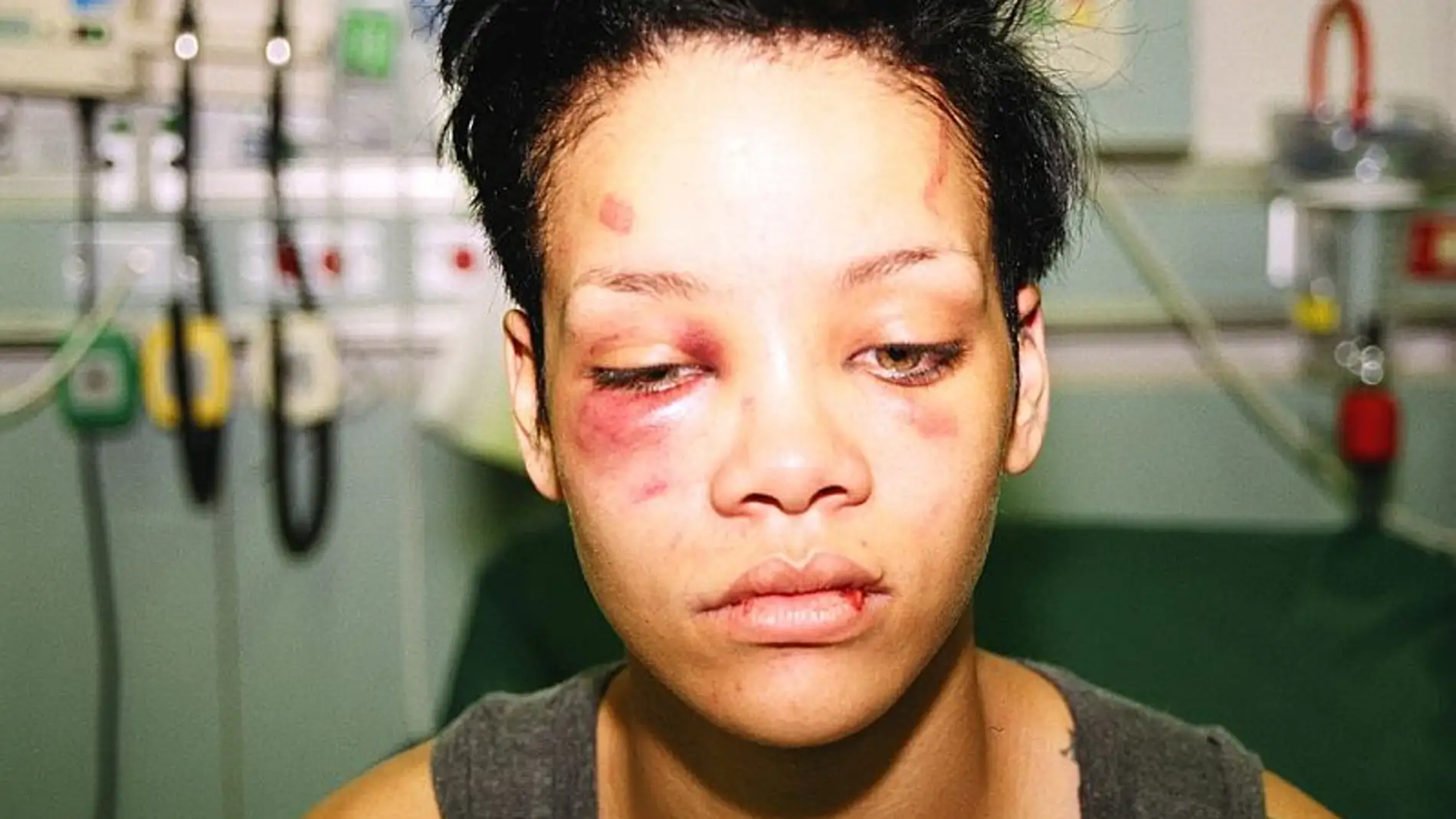 Rihanna agredida por Chris Brown