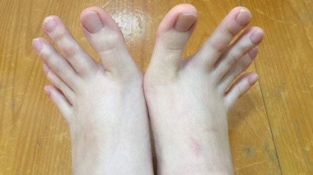 ¿Manos o pies?