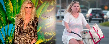 Kesha antes y después de su espectacular cambio