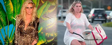 Kesha antes y después de su espectacular cambio Kesha antes y después de su espectacular cambio