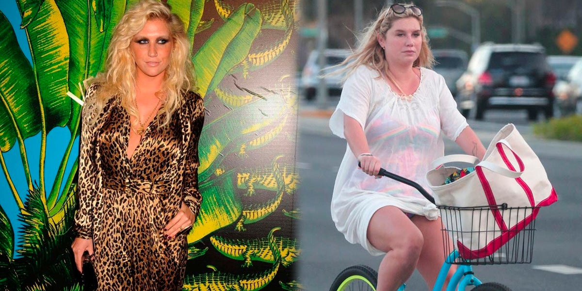 Kesha antes y después de su espectacular cambio