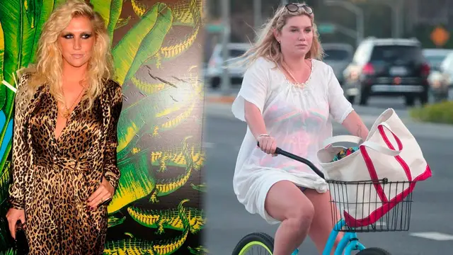 Kesha antes y después de su espectacular cambio