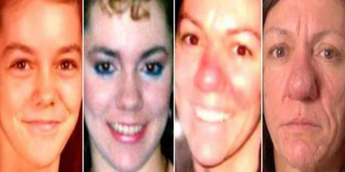 Rinofima, la enfermedad que sufre Pamela Ichard