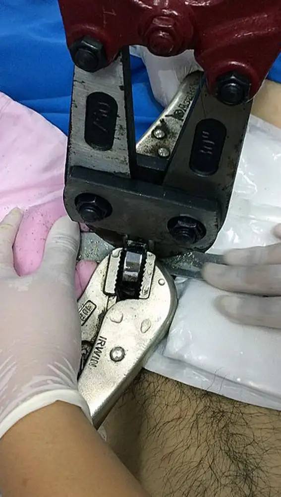 Se que queda atrapado el pene en un anillo Se que queda atrapado el pene en un anillo