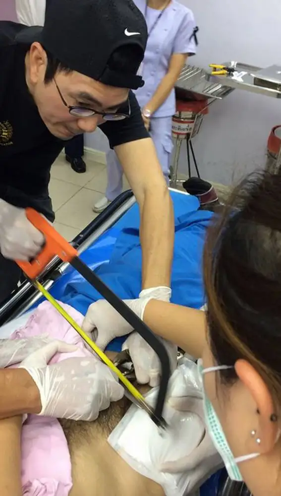 Intentaron cortar el anillo con una sierra Intentaron cortar el anillo con una sierra