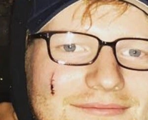 Ed Sheeran con el corte Ed Sheeran con el corte