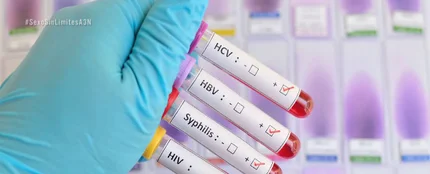Infecciones de transmisión sexual Infecciones de transmisión sexual