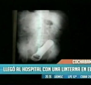 Descubren una linterna en el ano Descubren una linterna en el ano