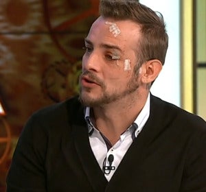 Àlex Casademunt habla sobre su agresión en una discoteca en Vigo Àlex Casademunt habla sobre su agresión en una discoteca en Vigo