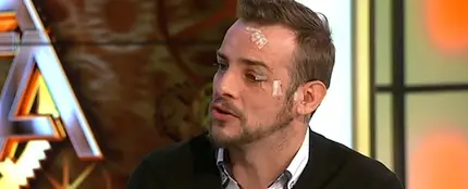 Àlex Casademunt habla sobre su agresión en una discoteca en Vigo Àlex Casademunt habla sobre su agresión en una discoteca en Vigo