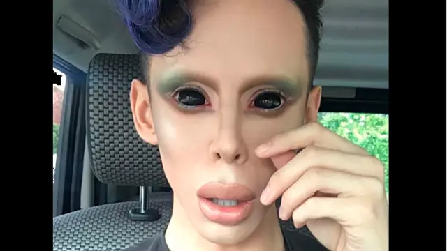 Vinny Ohh, el joven que se ha transformado en 'alien'