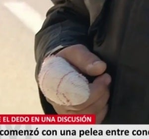 Un hombre arranca el dedo de un mordisco a otro tras una discusión de tráfico Un hombre arranca el dedo de un mordisco a otro tras una discusión de tráfico