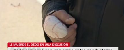 Un hombre arranca el dedo de un mordisco a otro tras una discusión de tráfico