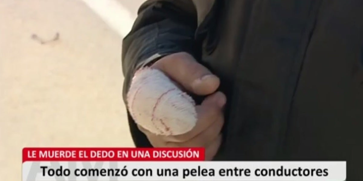 Un hombre arranca el dedo de un mordisco a otro tras una discusión de tráfico