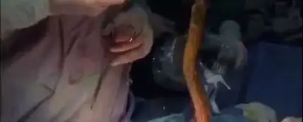 Una anguila siendo extraída durante la intervención quirúrgica Una anguila siendo extraída durante la intervención quirúrgica