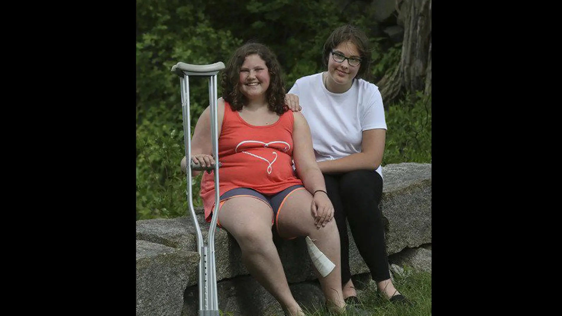 Megan Gething y su amiga tras la cirugía
