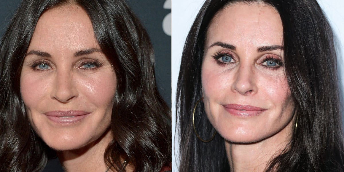 Courteney Cox disuelve sus rellenos faciales para recuperar naturalidad