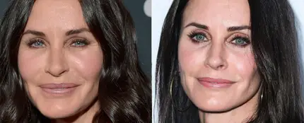 Courteney Cox disuelve sus rellenos faciales para recuperar naturalidad Courteney Cox disuelve sus rellenos faciales para recuperar naturalidad