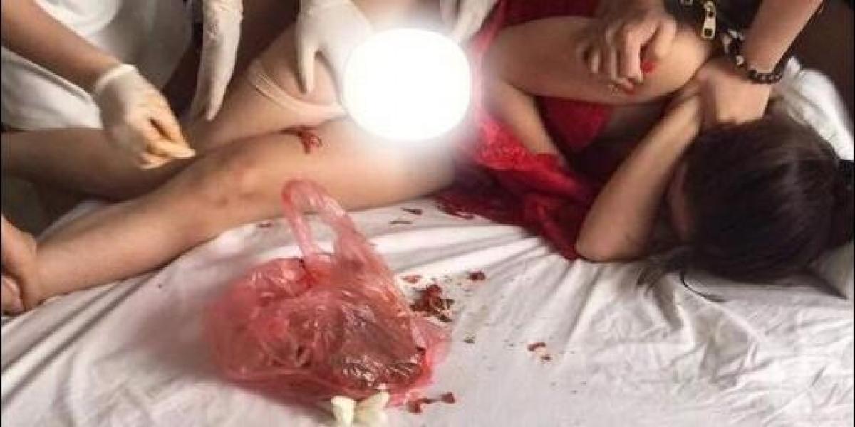 Introduce chile en la vagina de la amante de su marido como venganza