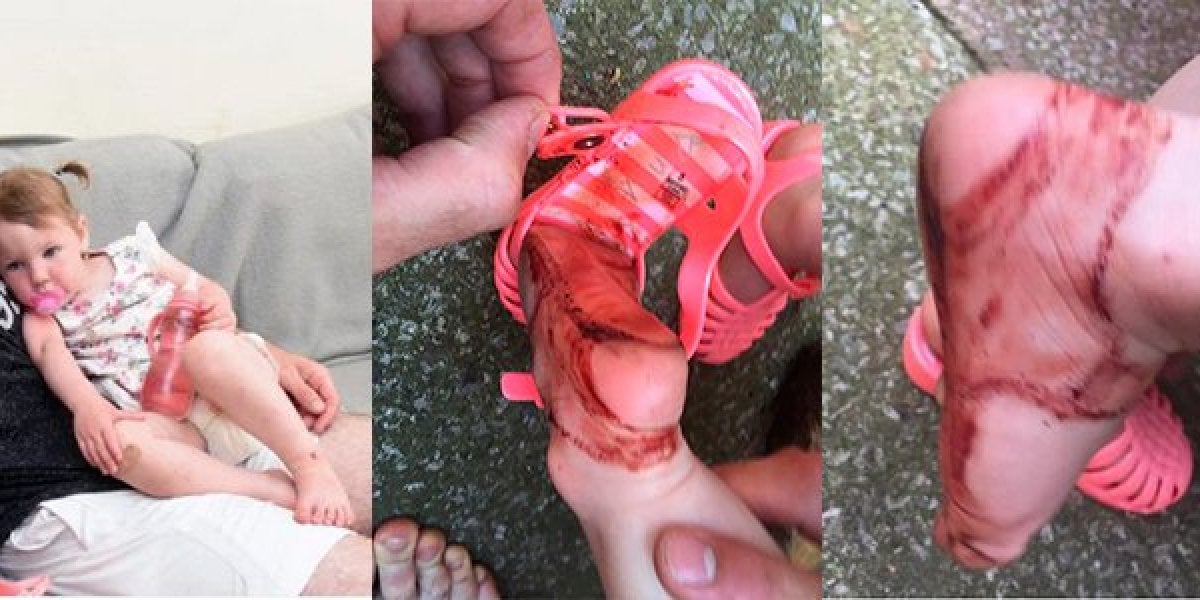 Las sandalias de goma: los zapatos más peligrosos para los niños