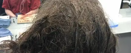 Estado del pelo con el que llegó la adolescente deprimida Estado del pelo con el que llegó la adolescente deprimida