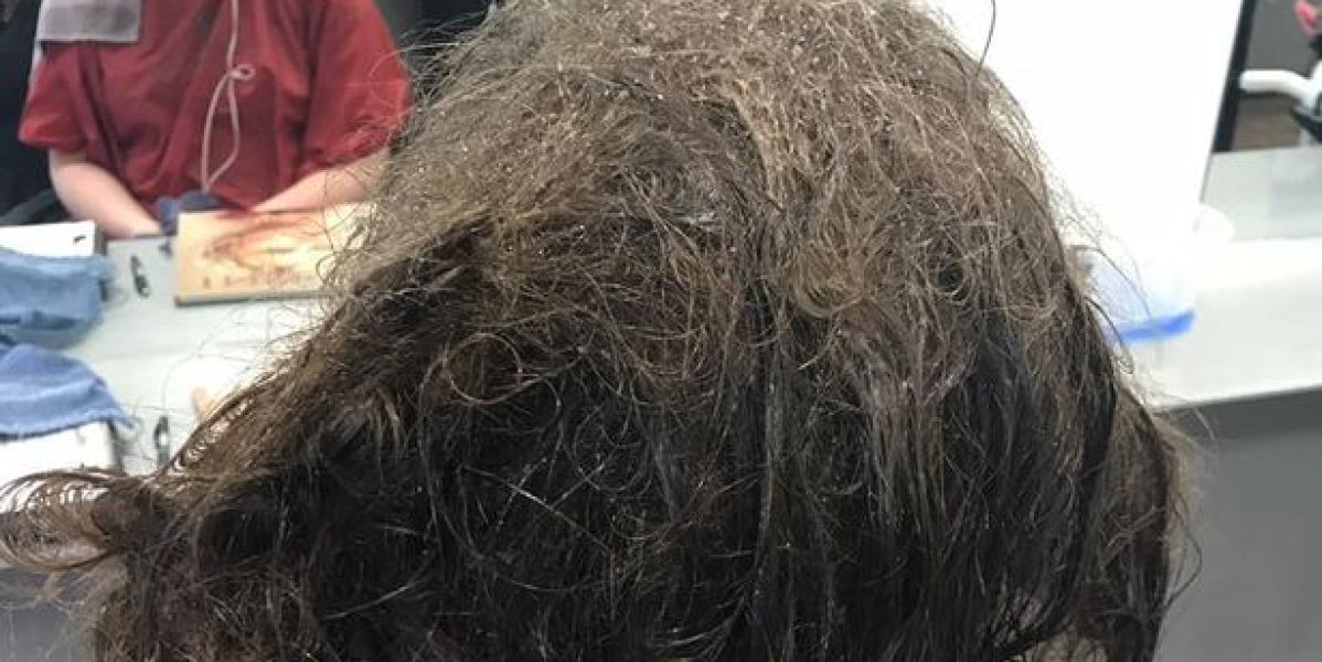 Estado del pelo con el que llegó la adolescente deprimida