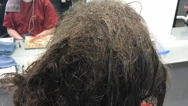 Estado del pelo con el que llegó la adolescente deprimida